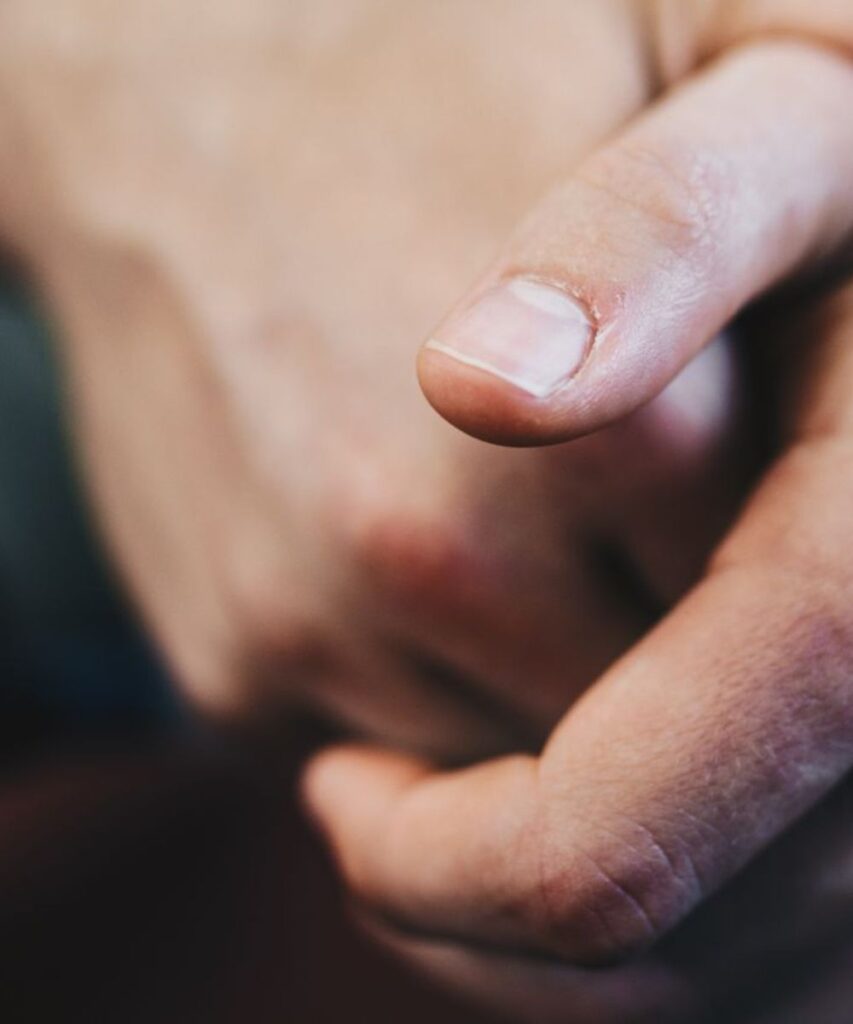 Why do my nails keep breaking, featuring a close-up of a short natural fingernail